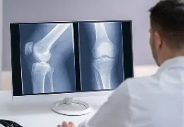 doctor reviewing x-rays