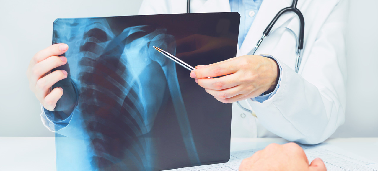 Radiology & Diagnostic Imaging in Ohio Crystal Clinic Orthopedic Center